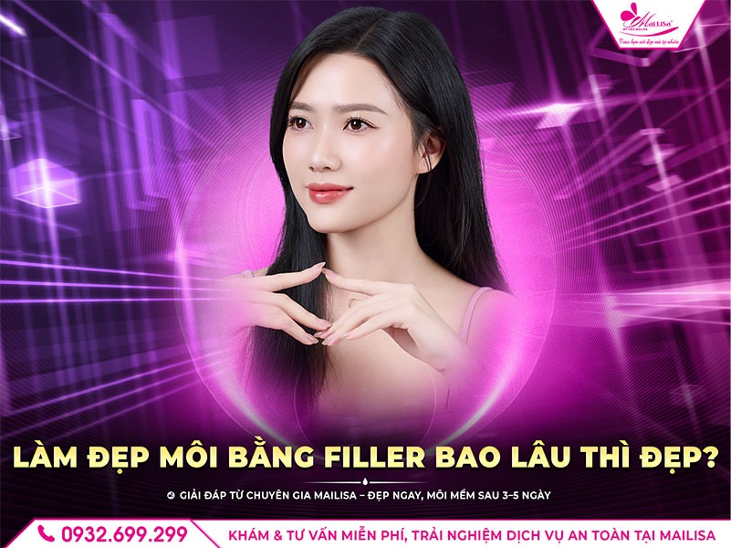 lam-dep-filler-moi-bao-lau-thi-dep