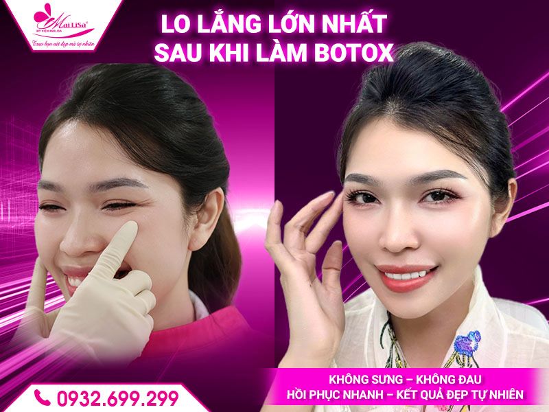 lo-lang-lon-nhat-sau-khi-lam-botox
