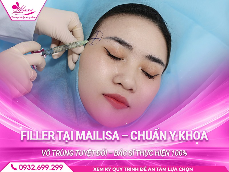 mailisa-co-lam-dep-bang-filler-khong