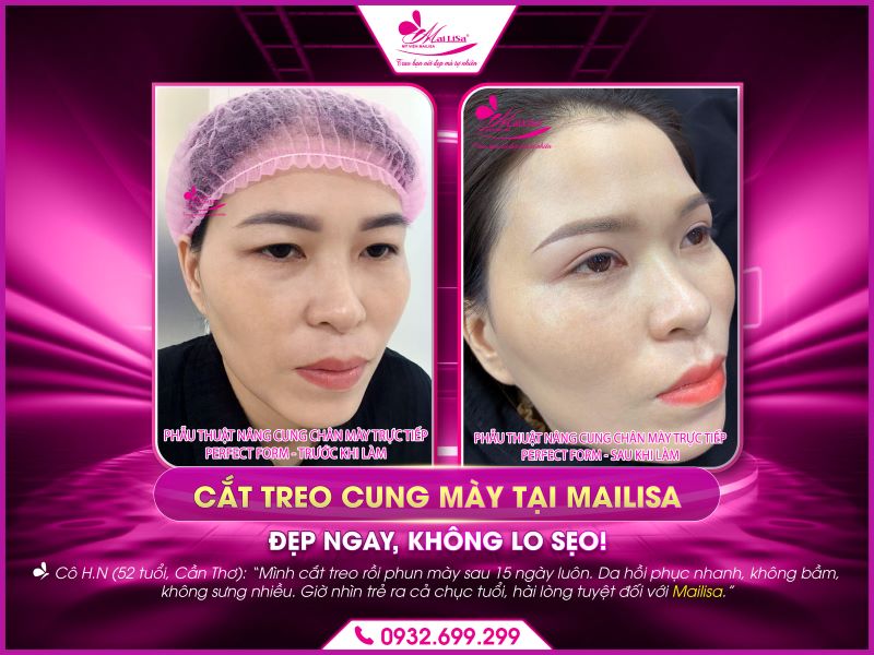 mailisa-dep-ngay-khong-lo-seo