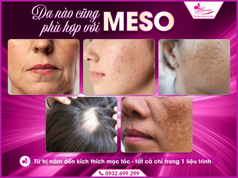 meso-co-tac-dung-gi