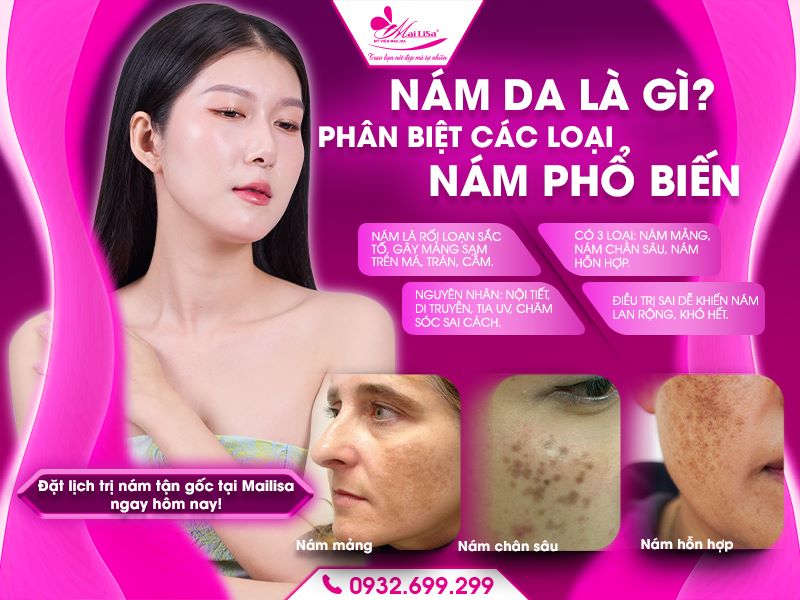 nam-da-la-gi