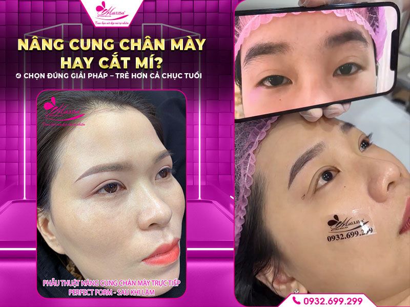 nang-cung-chan-may-hay-cat-mi