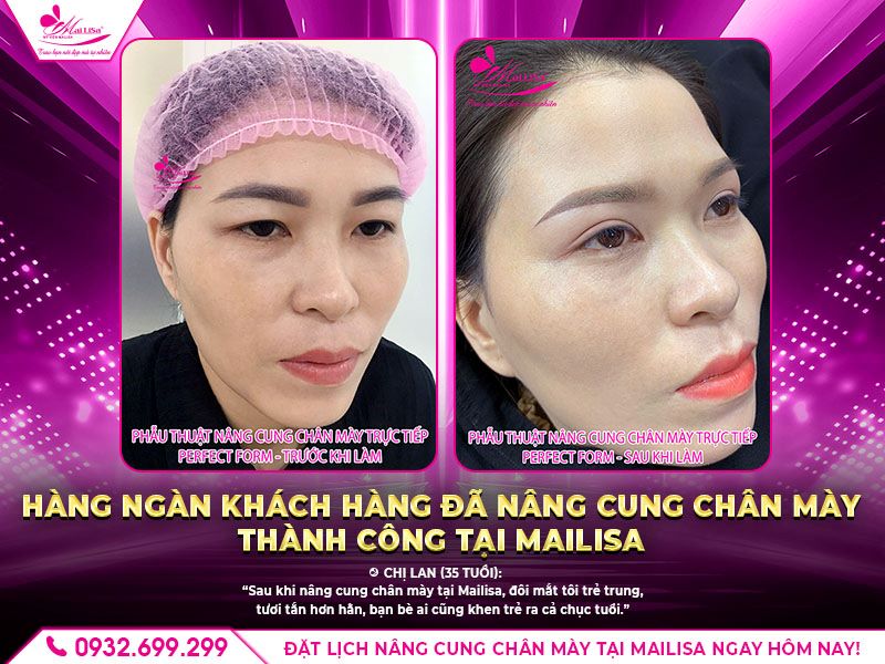 nang-cung-chan-may-thanh-cong-tai-mailisa
