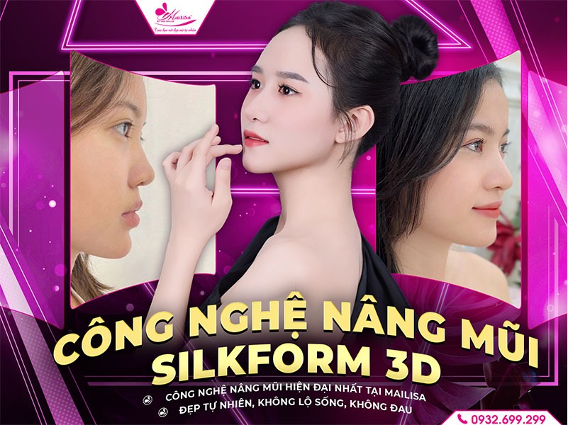nang-mui-silkform-3d-la-gi