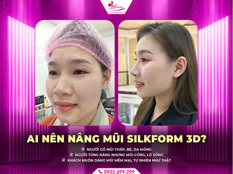 nang-mui-silkform-3d-la-gi