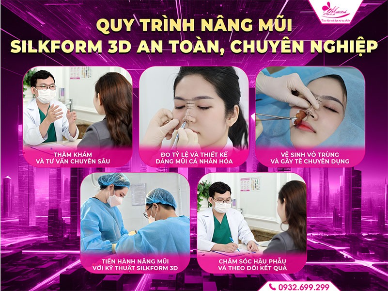 nang-mui-silkform-3d-la-gi
