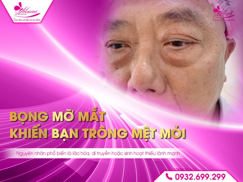 nen-cat-bong-mo-mat-khong