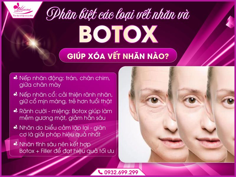 phan-biet-cac-loai-vet-nhan
