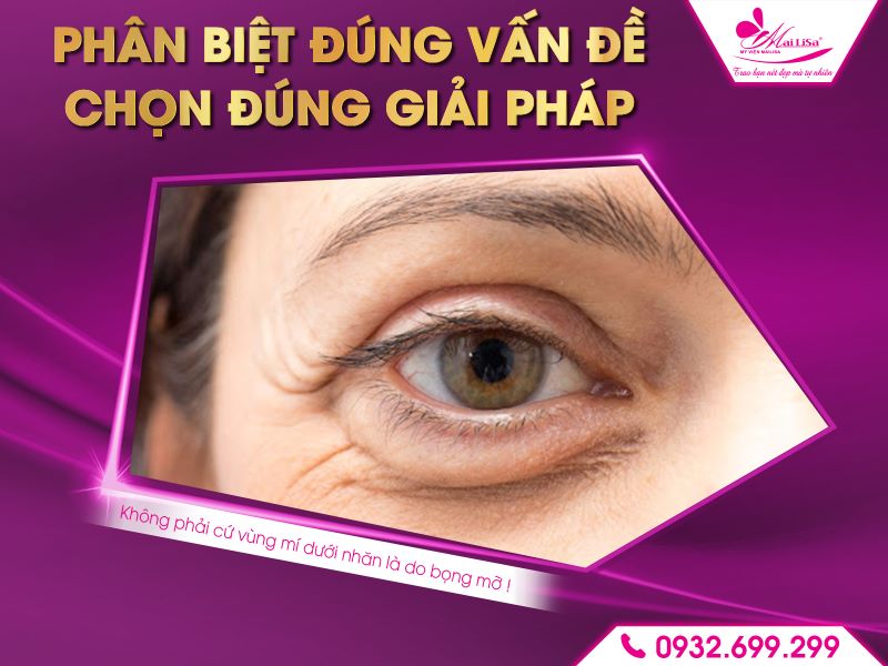phan-biet-dung-van-de-chon-dung-giai-phap