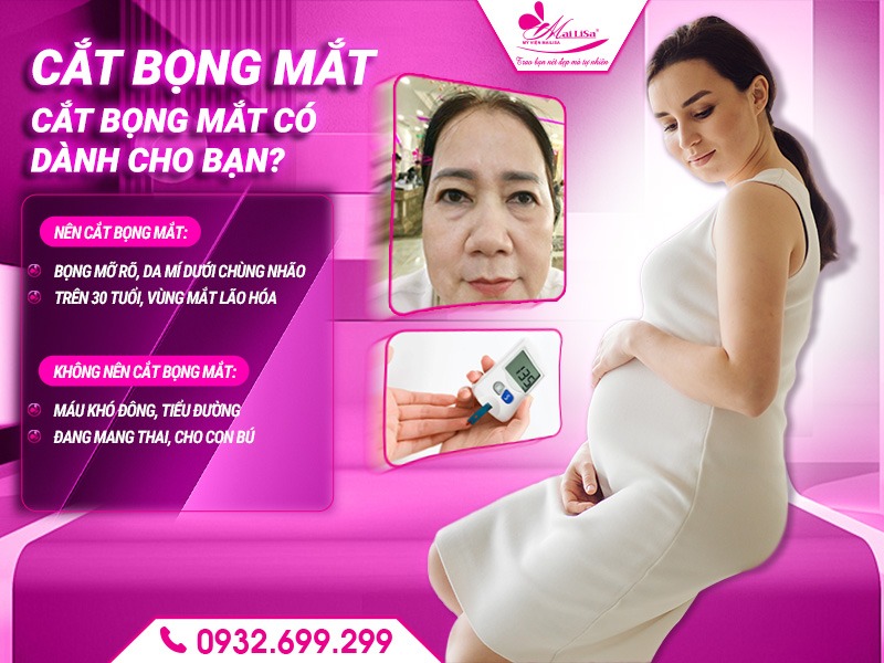 phau-thuat-cat-bong-mat-la-gi