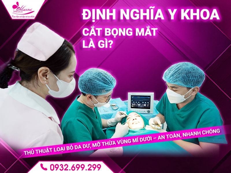 phau-thuat-cat-bong-mat-la-gi