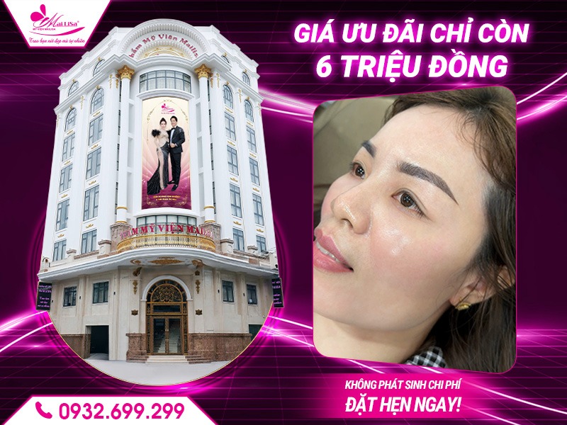 phau-thuat-cat-bong-mat-la-gi