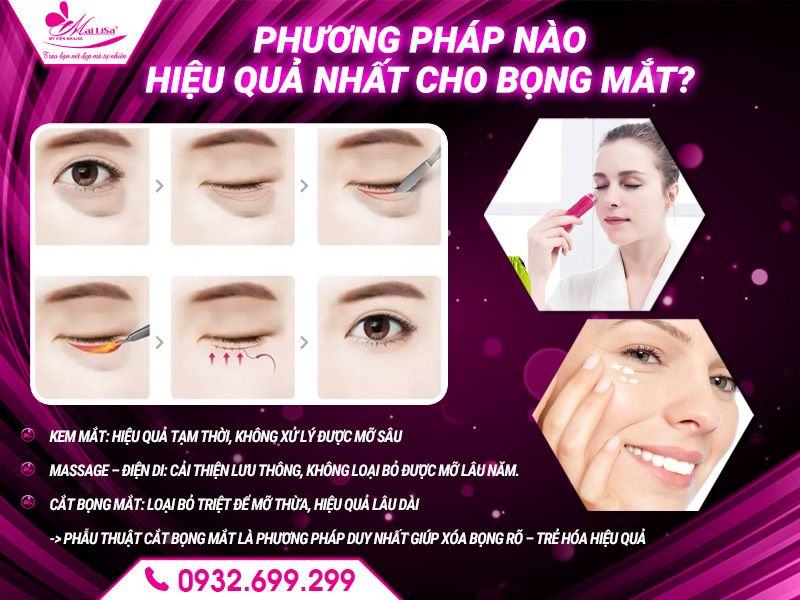 phuong-phap-nao-hieu-qua-nhat-cho-bong-mat