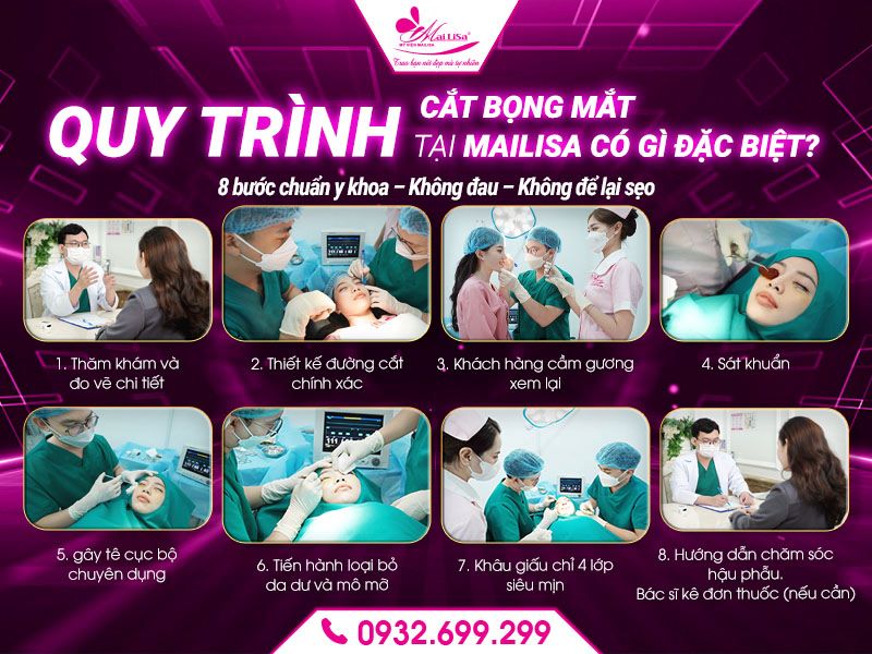 quy-trinh-cat-bong-mat-tai-mailisa