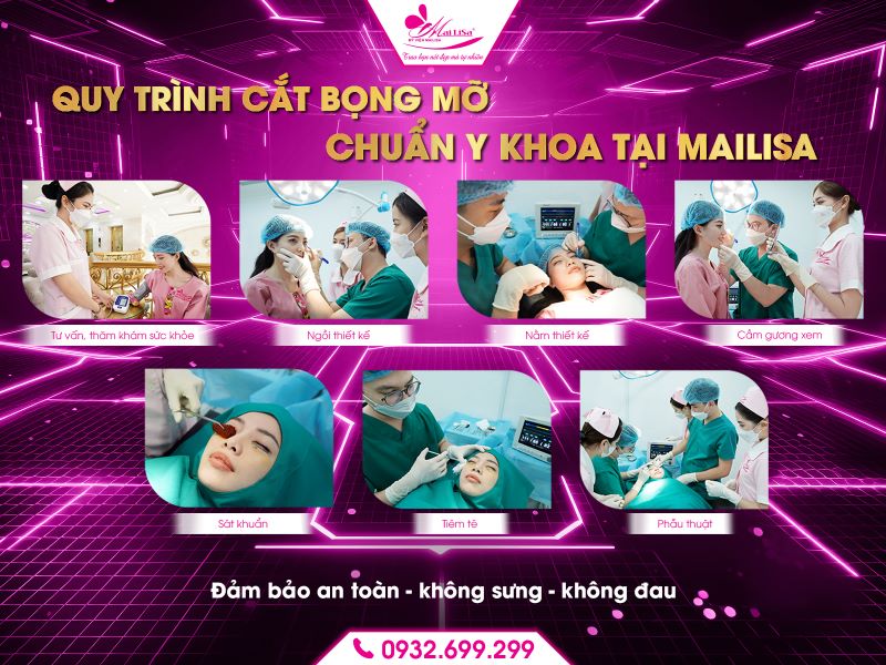 quy-trinh-cat-bong-mo-chuan-y-khoa-tai-mailisa