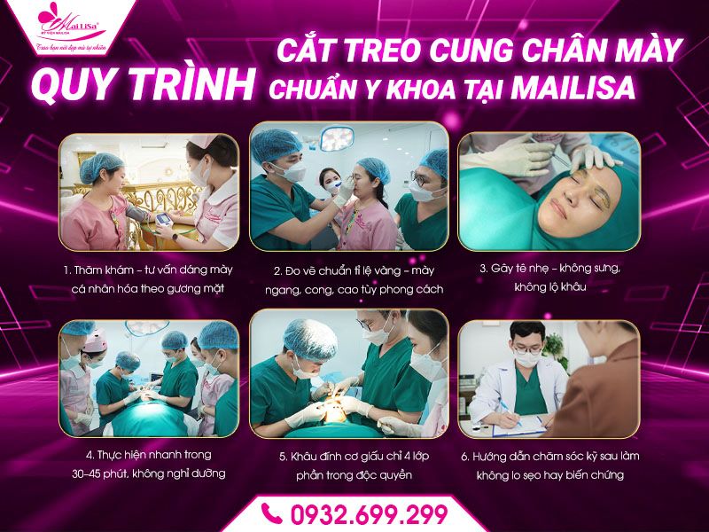 quy-trinh-cat-treo-cung-chan-may-chuan-y-khoa-tai-mailisa