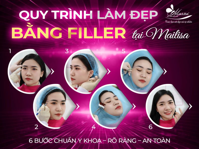 quy-trinh-lam-dep-bang-filler-tai-mailisa