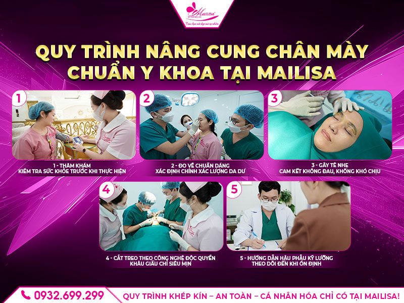 quy-trinh-nang-cung-chan-may-tai-mailisa