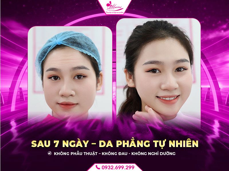 sau-7-ngay-dep-tu-nhien