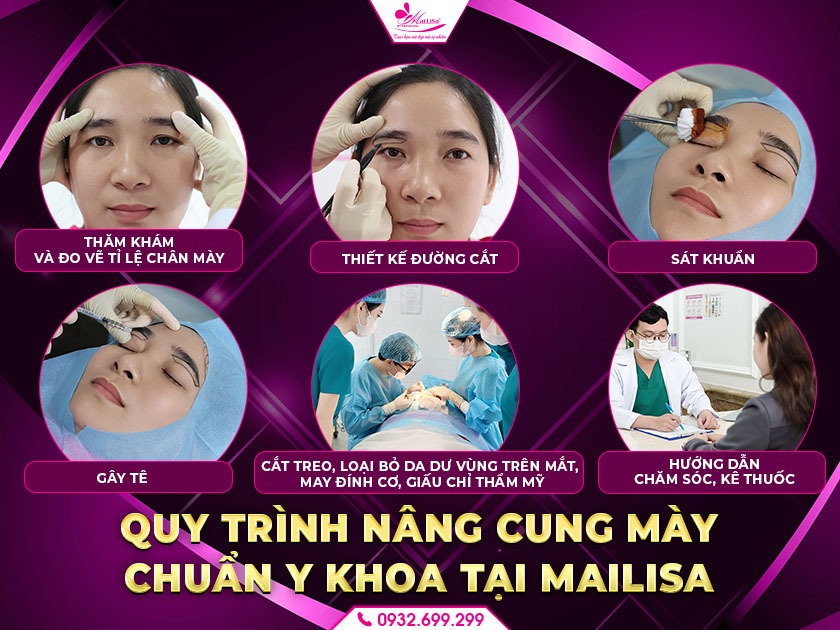 sau-nang-cung-chan-may-co-bi-bam-khong