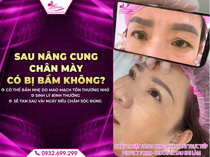 sau-nang-cung-chan-may-co-bi-bam-khong