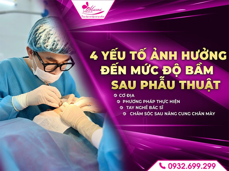sau-nang-cung-chan-may-co-bi-bam-khong