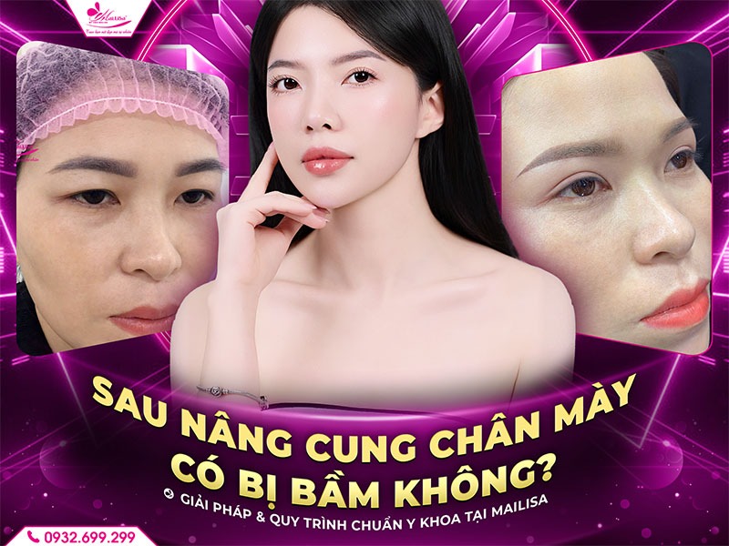 sau-nang-cung-chan-may-co-bi-bam-khong