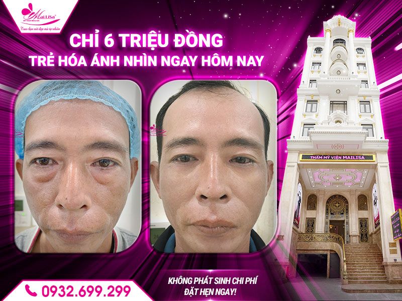 tre-hoa-anh-nhin-ngay-hom-nay