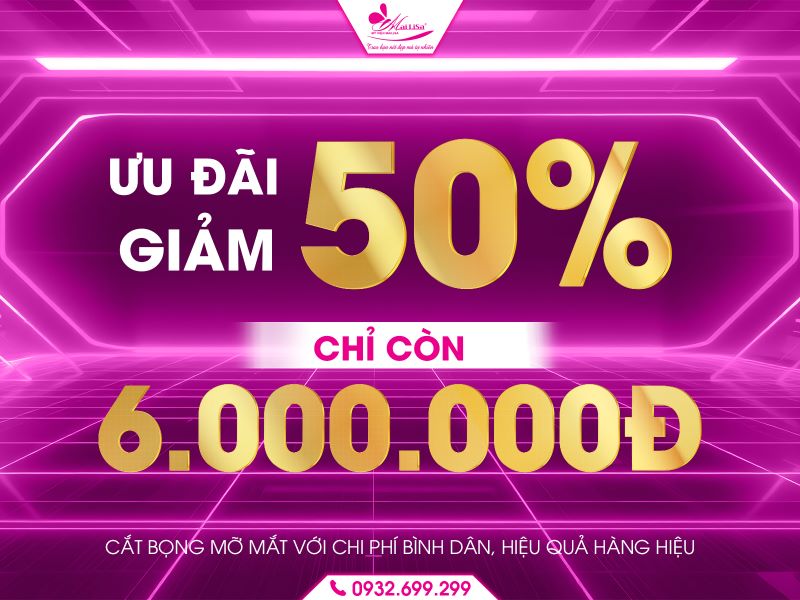 uu-dai-giam-50