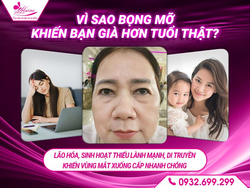 vi-sao-bong-mo-khien-ban-gia-hon