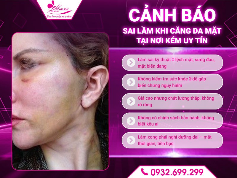 vi-sao-nen-chon-mailisa-ha-noi-cang-da-mat