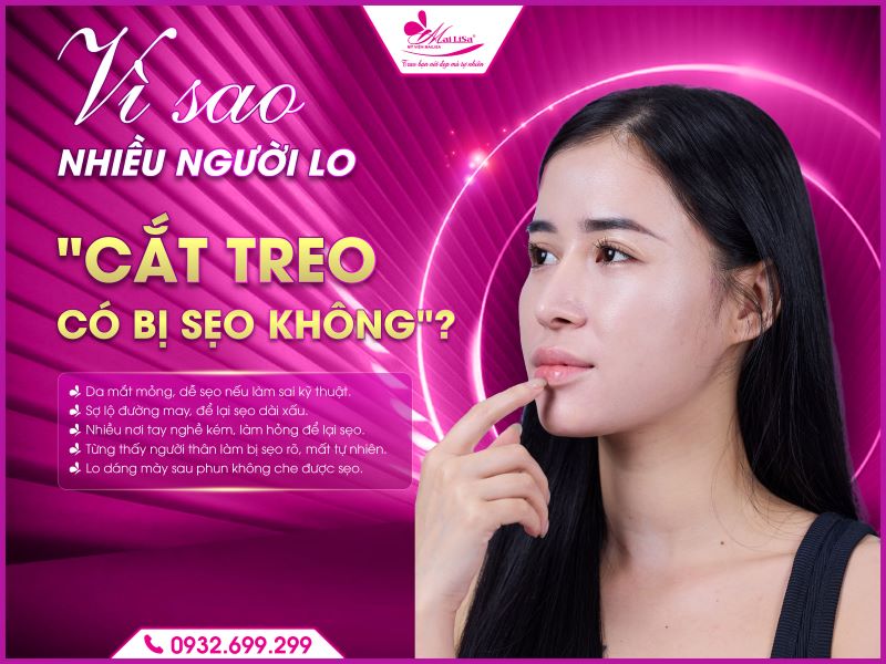 vi-sao-nhieu-nguoi-lo-cat-treo-bi-seo