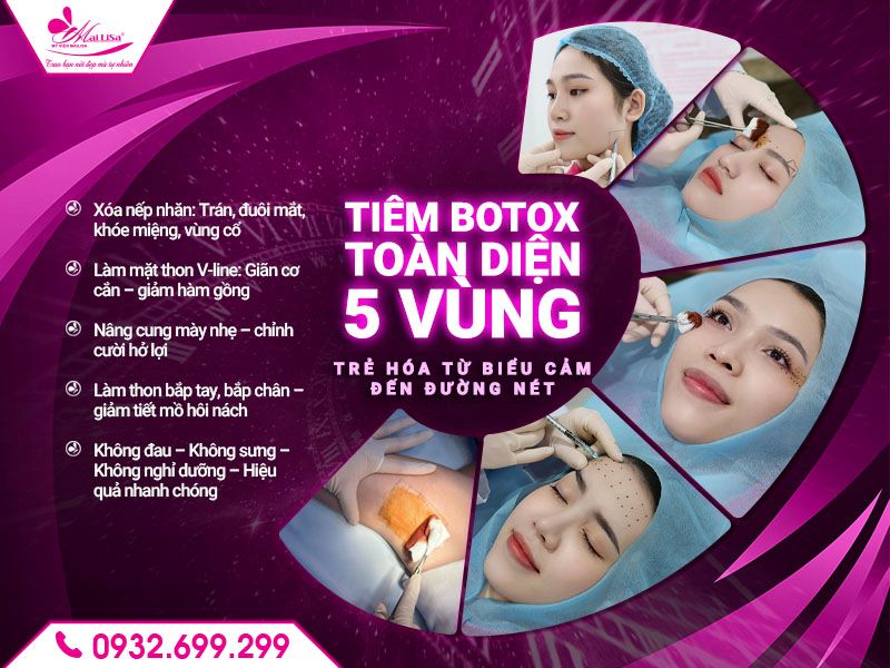 vung-tiem-botox-toan-mat-mailisa