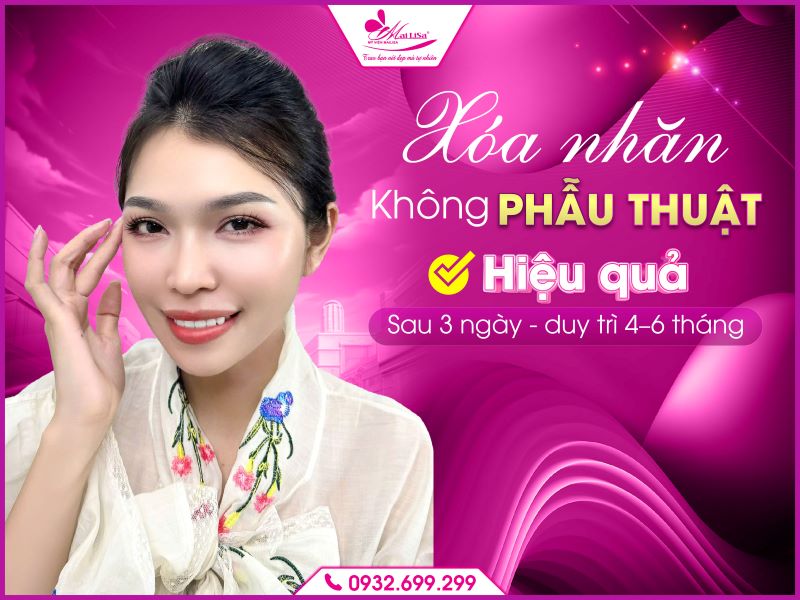 xoa-nhan-khong-phau-thuat