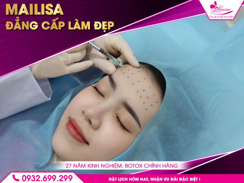 27-nam-kinh-nghiem-botox-chinh-hang