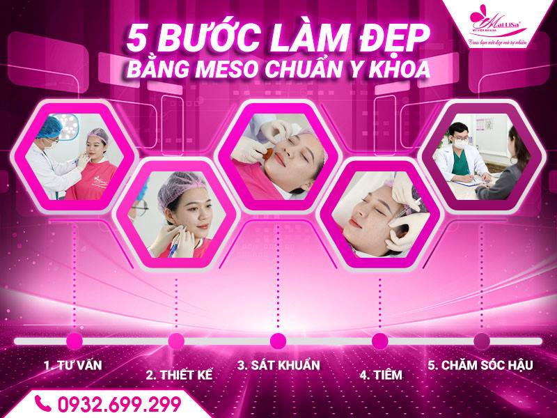 5-buoc-lam-dep-bang-meso-chuan-y-khoa