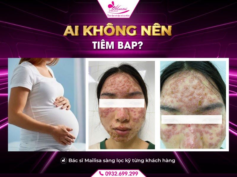 ai-khong-nen-tiem-bap