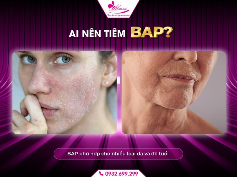 ai-nen-tiem-bap