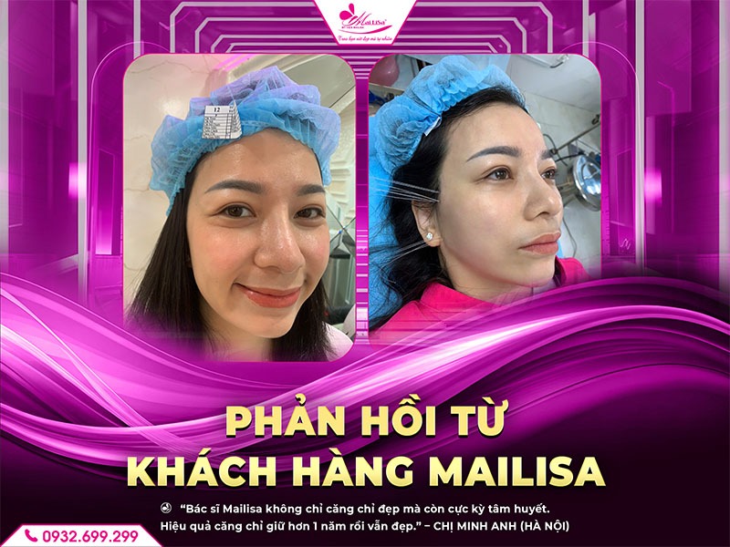 thuc-pham-nen-an-sau-khi-cang-da-mat