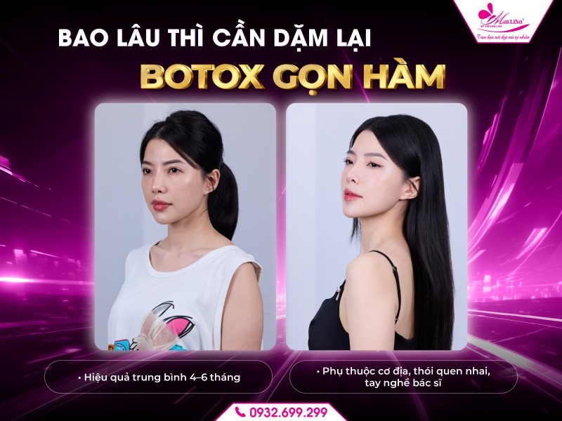 botox-gon-ham-co-can-dam-lai-khong