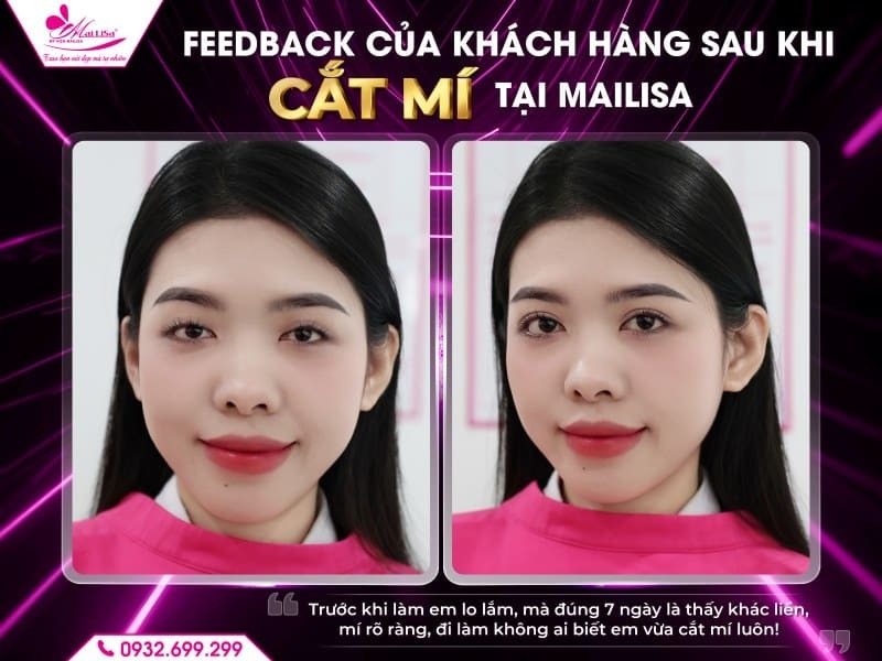 bao-lau-thi-mi-vao-form-sau-khi-cat-mi