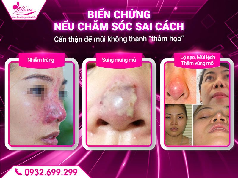 bien-chung-neu-cham-soc-sai-cach