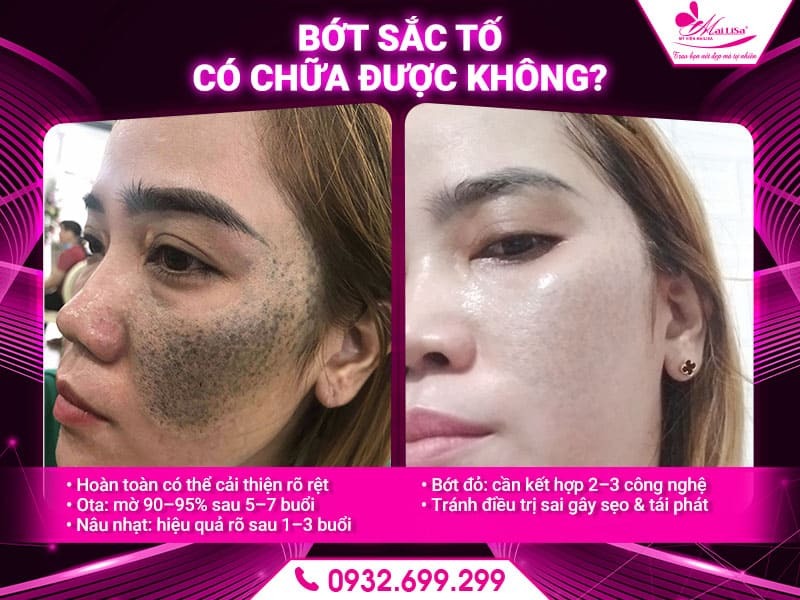 bot-sac-to-co-chua-duoc-khong