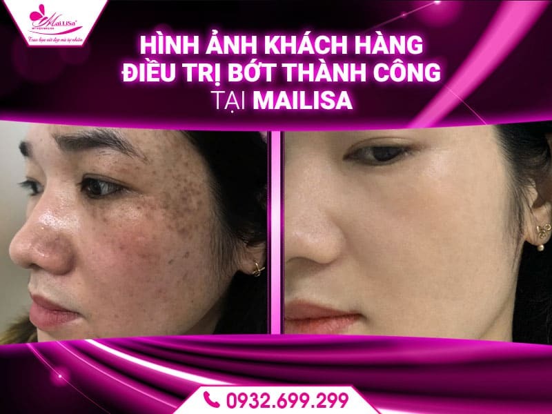 bot-sac-to-co-chua-duoc-khong
