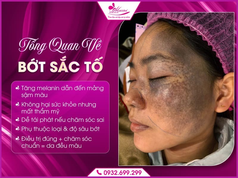 bot-sac-to-co-tai-phat-sau-dieu-tri-khong