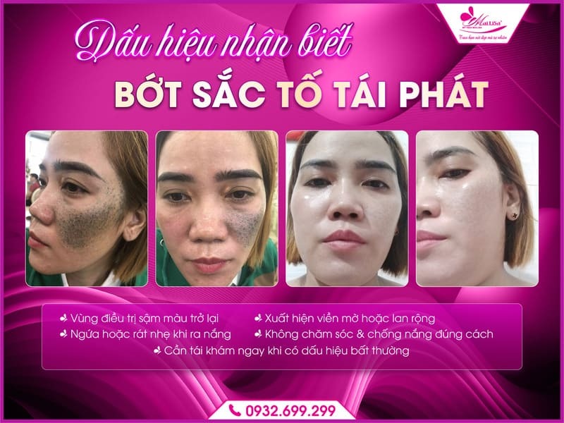 bot-sac-to-co-tai-phat-sau-dieu-tri-khong