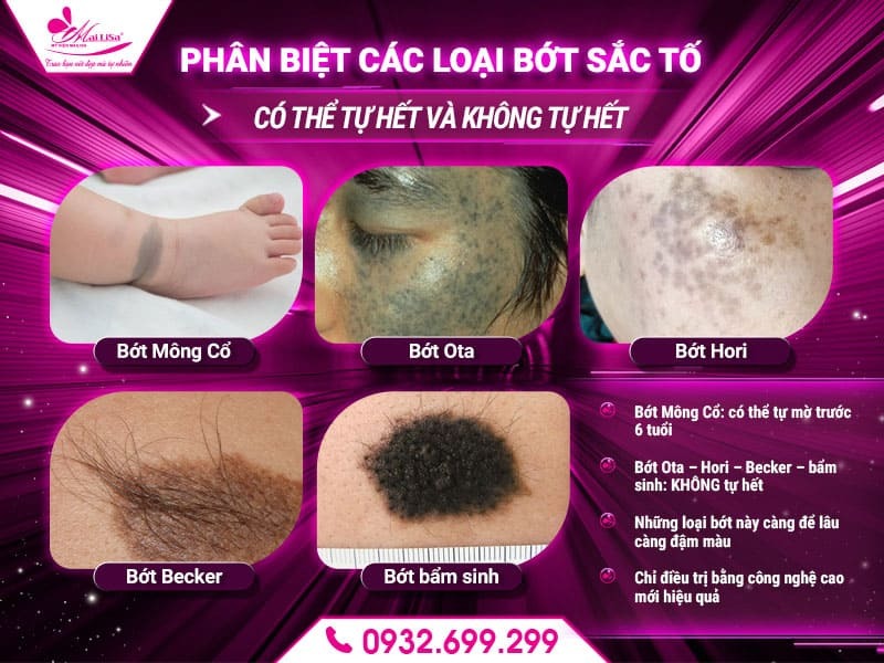 bot-sac-to-co-tu-het-khong