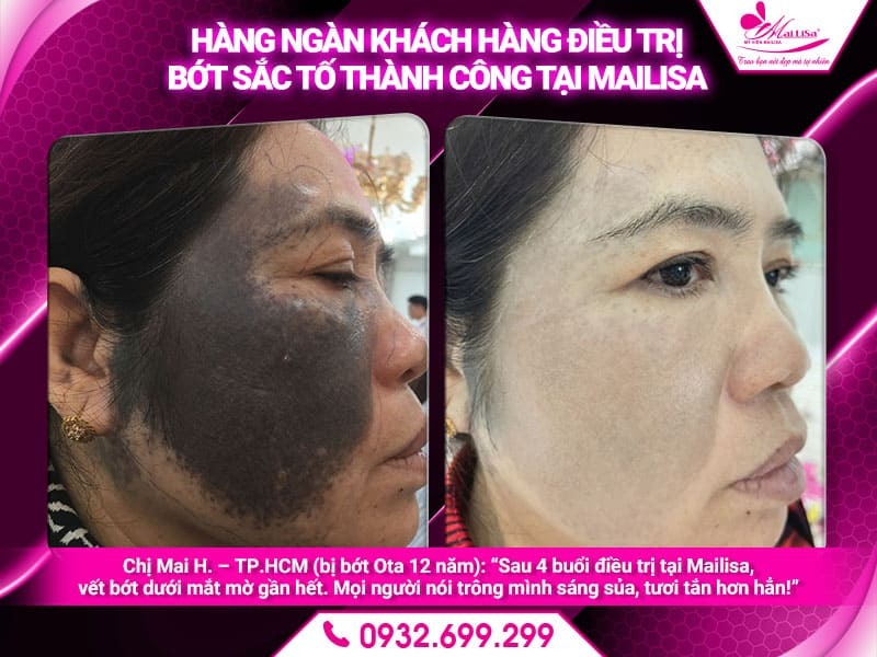 bot-sac-to-co-tu-het-khong
