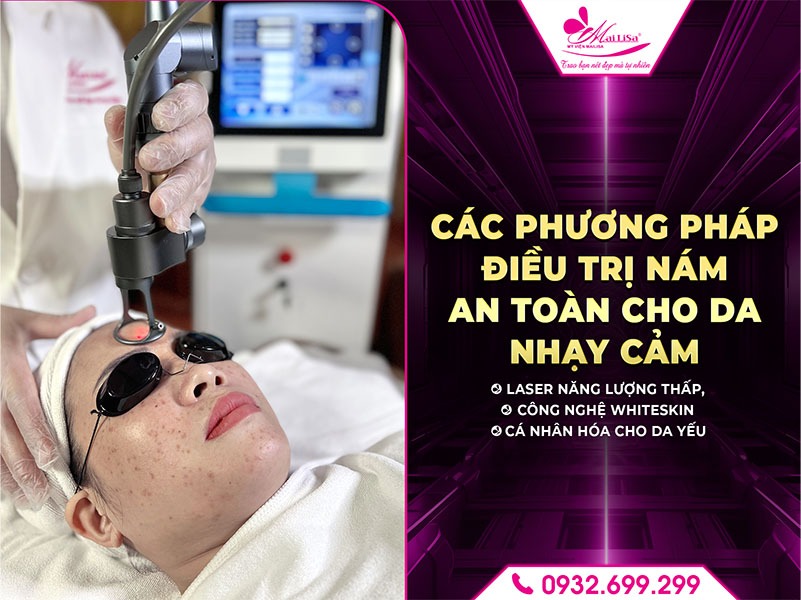 dieu-tri-nam-cho-da-nhay-cam